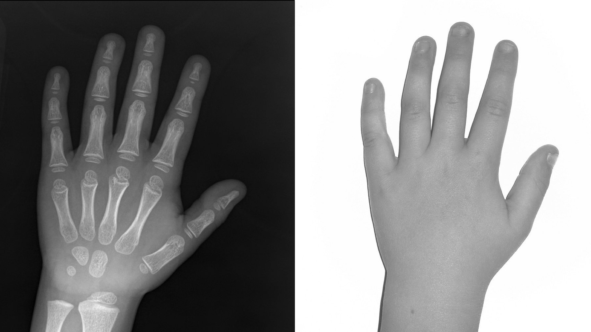 Child hand